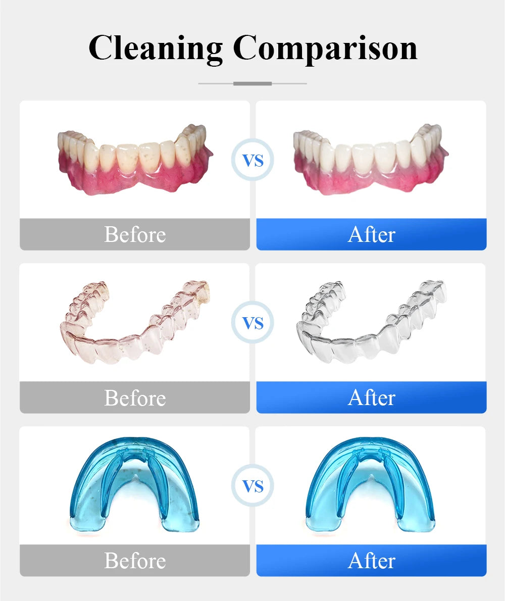 Tullker Ultrasonic Retainer Cleaner For Dentures And Braces UV